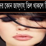 তিল থাকলে কি হয়